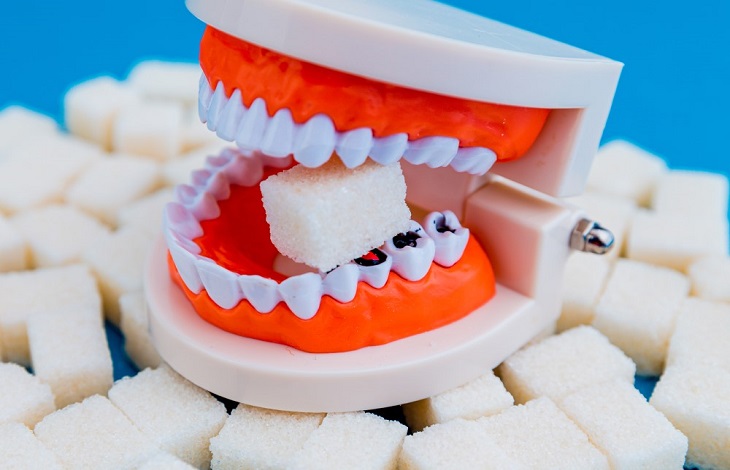 Why Sugar Is Destroying Your Teeth
