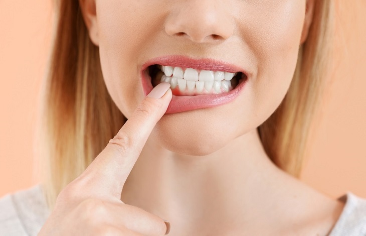 Gum Disease: Causes, Symptoms, and Solutions