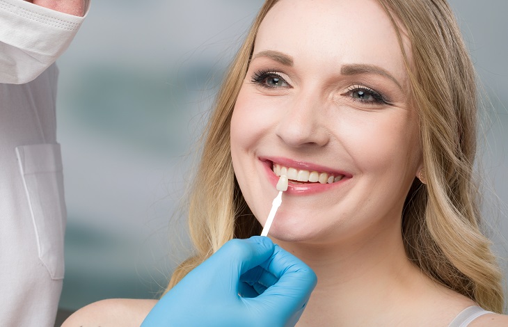 An Overview of Veneers: What Are They, and When Are They Required?