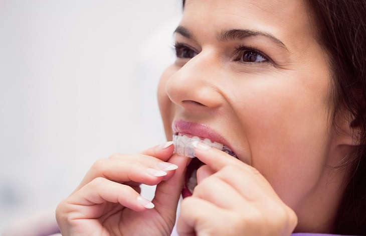 A Clearly Different Approach to Teeth Straightening with Maroubra Dentist